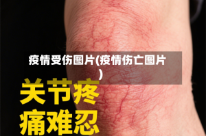 疫情受伤图片(疫情伤亡图片)