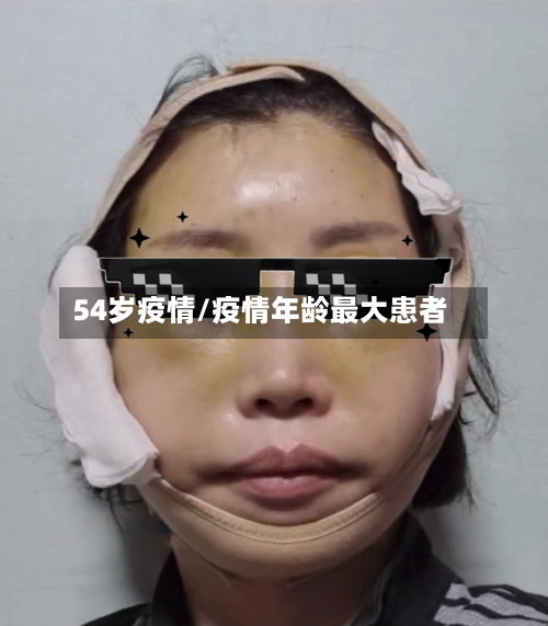 54岁疫情/疫情年龄最大患者-第1张图片