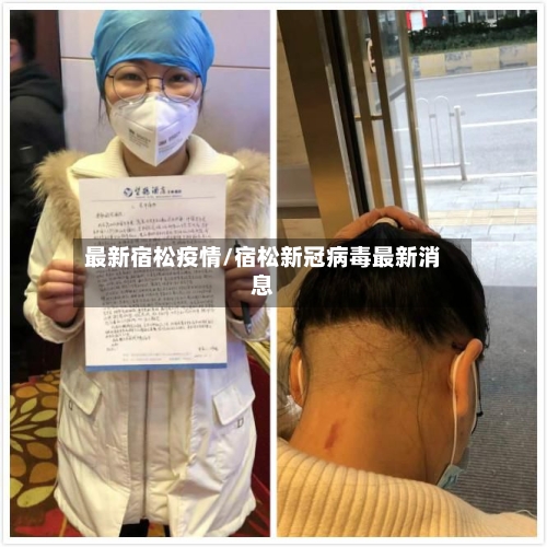 最新宿松疫情/宿松新冠病毒最新消息-第2张图片