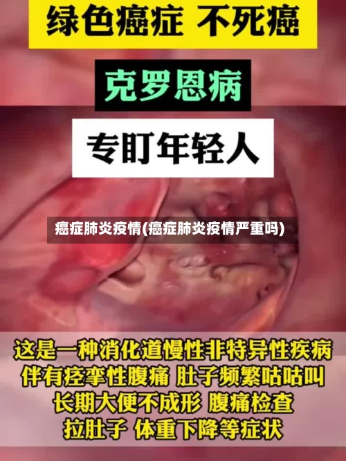 癌症肺炎疫情(癌症肺炎疫情严重吗)-第1张图片