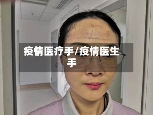 疫情医疗手/疫情医生手-第1张图片