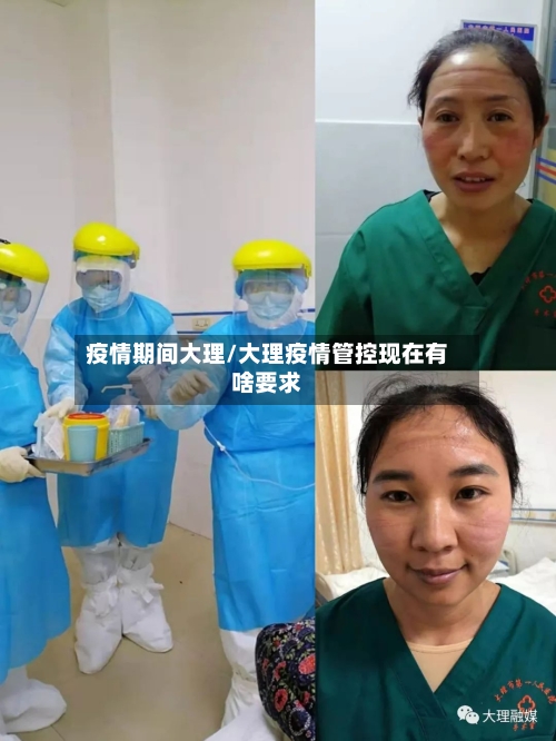 疫情期间大理/大理疫情管控现在有啥要求-第1张图片